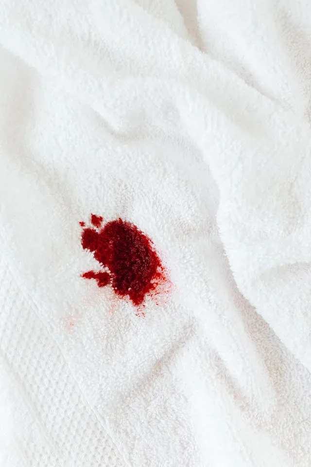 8 ways to remove blood stains from white clothes